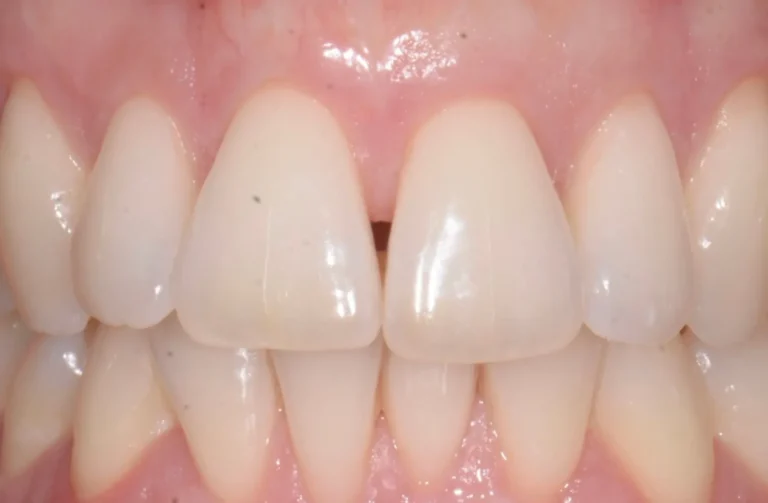 Io Sorrido - Studio Dentistico a Borgoricco
