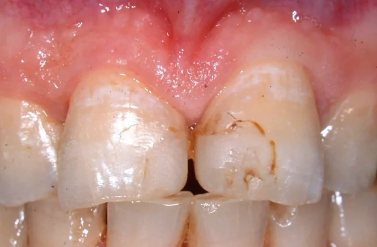 Io Sorrido - Studio Dentistico a Borgoricco