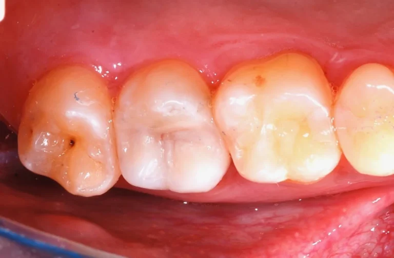 Io Sorrido - Studio Dentistico a Borgoricco