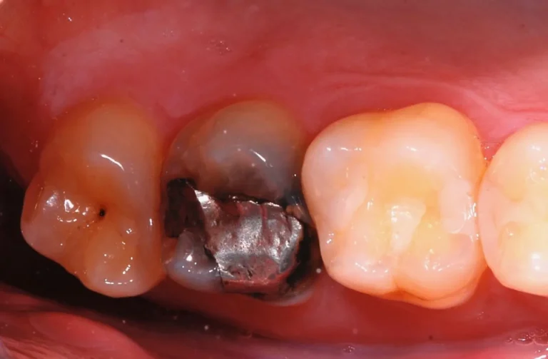 Io Sorrido - Studio Dentistico a Borgoricco