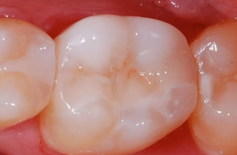 Io Sorrido - Studio Dentistico a Borgoricco