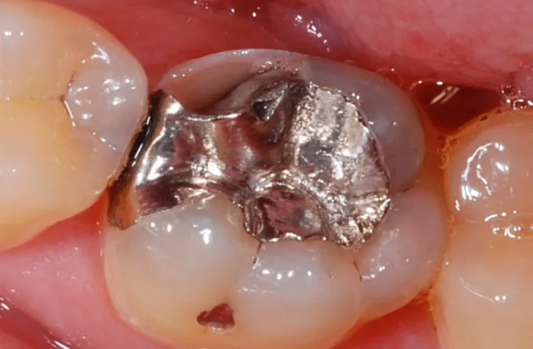 Io Sorrido - Studio Dentistico a Borgoricco