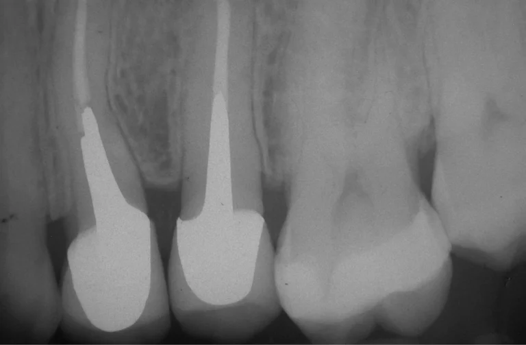 Io Sorrido - Studio Dentistico a Borgoricco