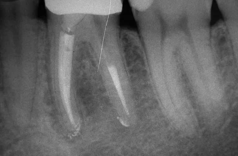 Io Sorrido - Studio Dentistico a Borgoricco