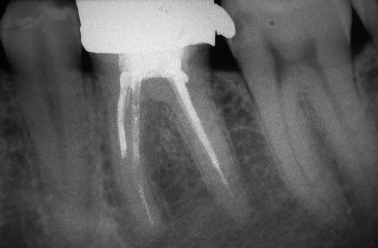 Io Sorrido - Studio Dentistico a Borgoricco