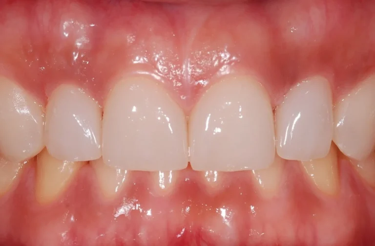 Io Sorrido - Studio Dentistico a Borgoricco