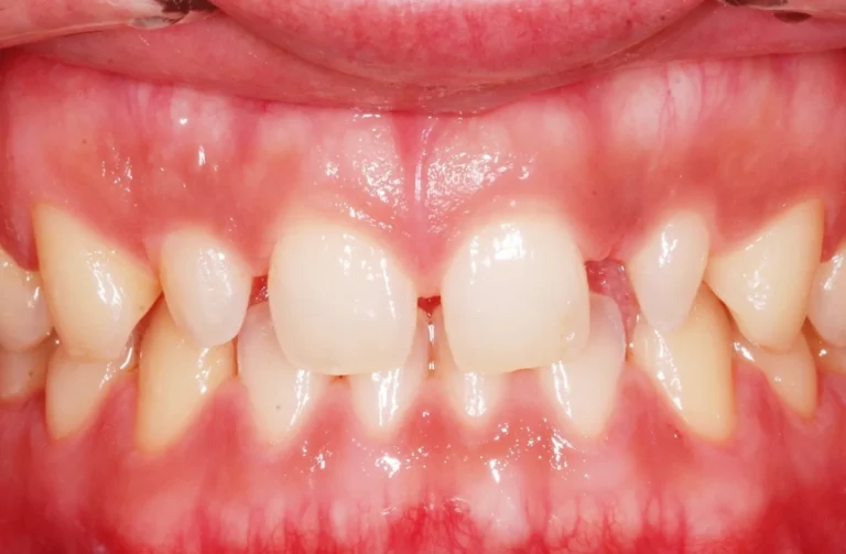 Io Sorrido - Studio Dentistico a Borgoricco