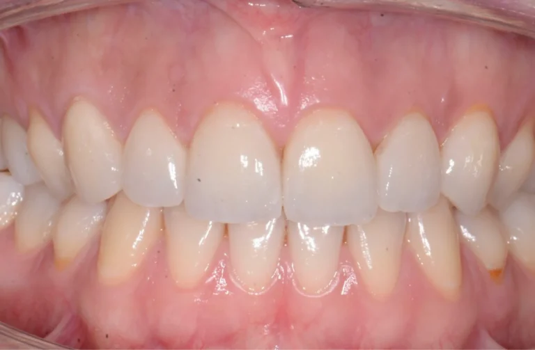 Io Sorrido - Studio Dentistico a Borgoricco