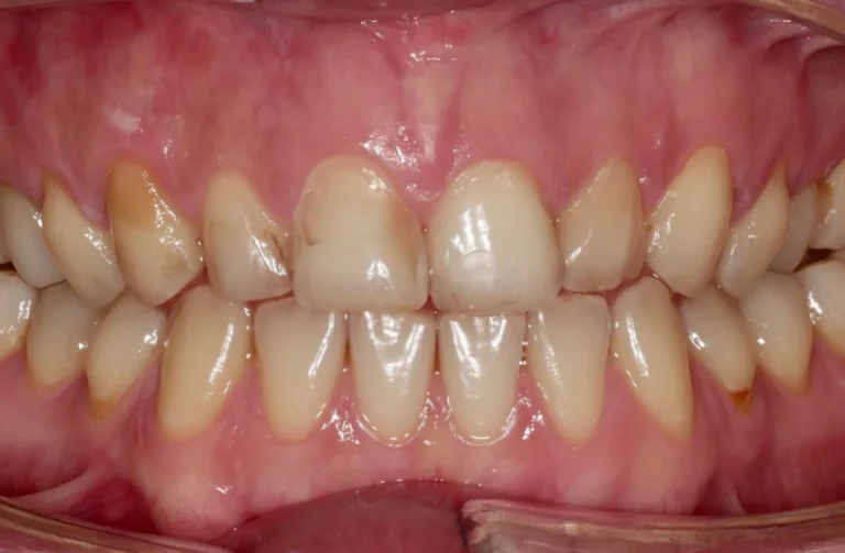 Io Sorrido - Studio Dentistico a Borgoricco