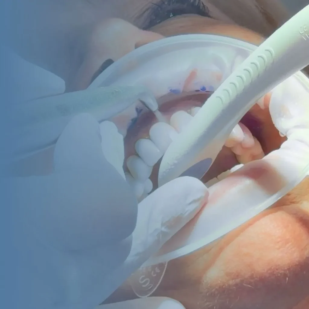 igiene dentale a Borgoricco