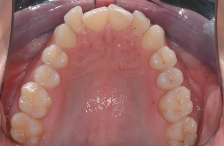 Io Sorrido - Studio Dentistico a Borgoricco