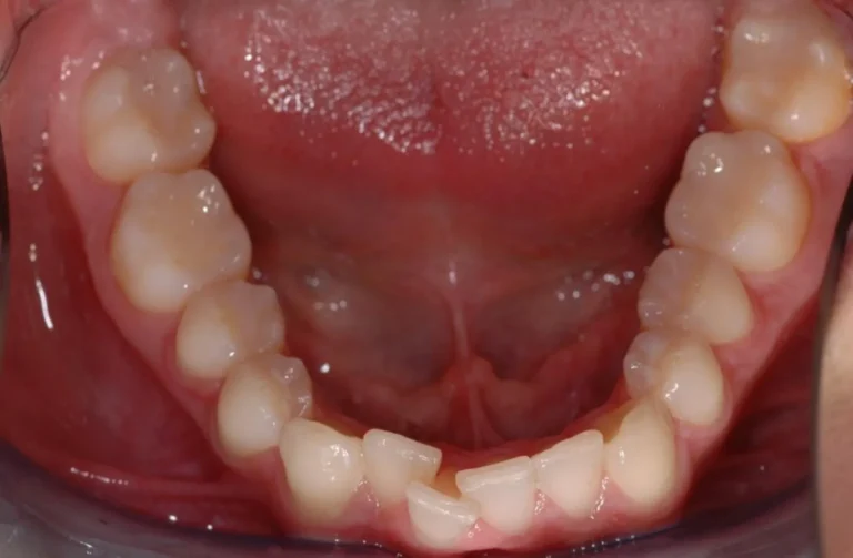 Io Sorrido - Studio Dentistico a Borgoricco
