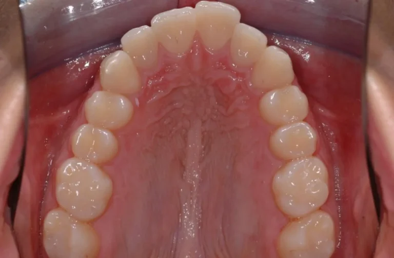 Io Sorrido - Studio Dentistico a Borgoricco