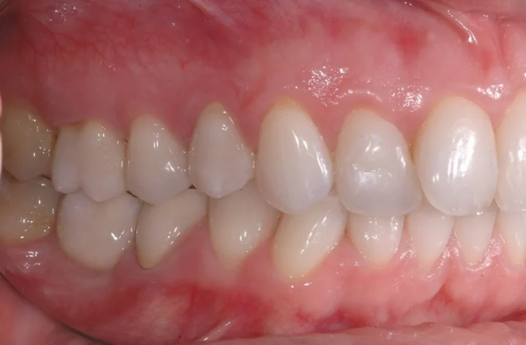 Io Sorrido - Studio Dentistico a Borgoricco