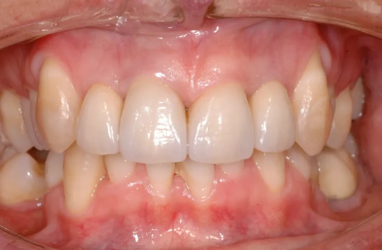 Io Sorrido - Studio Dentistico a Borgoricco