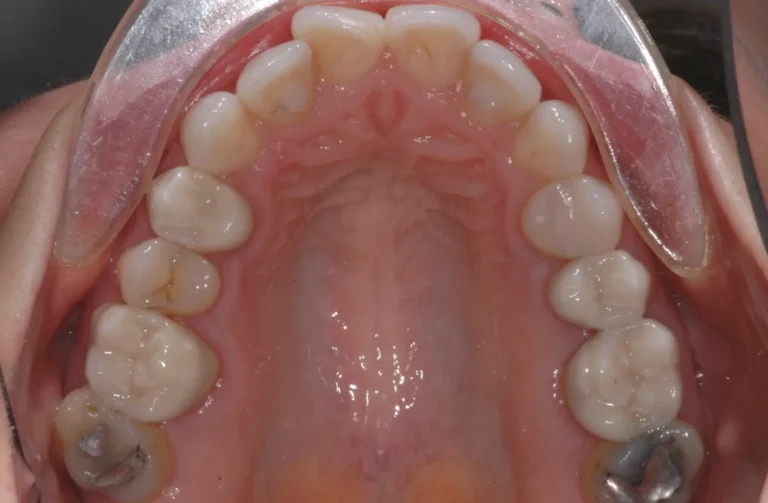 Io Sorrido - Studio Dentistico a Borgoricco