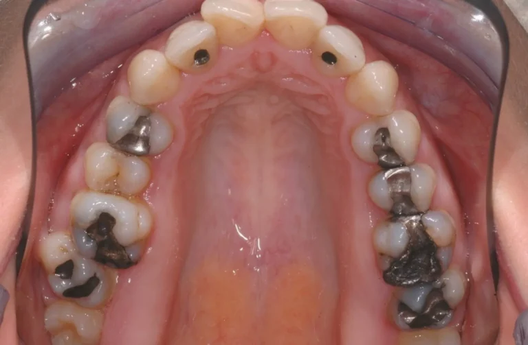 Io Sorrido - Studio Dentistico a Borgoricco