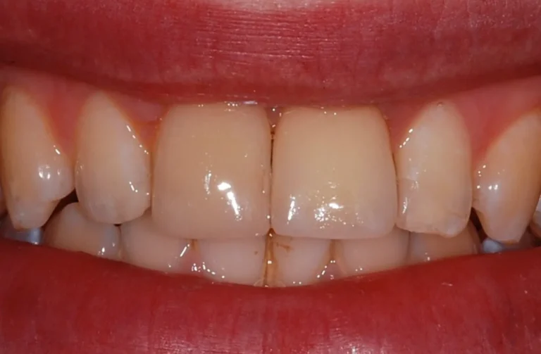 Io Sorrido - Studio Dentistico a Borgoricco